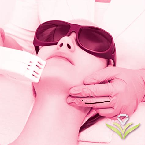 Comprar Skin Depilacion Laser Neuquen Barato&nbsp;Preço